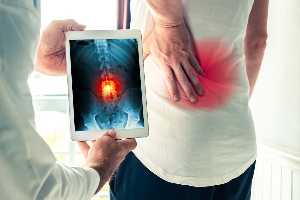 Spine X-Ray at Limitless Life Chiropractic